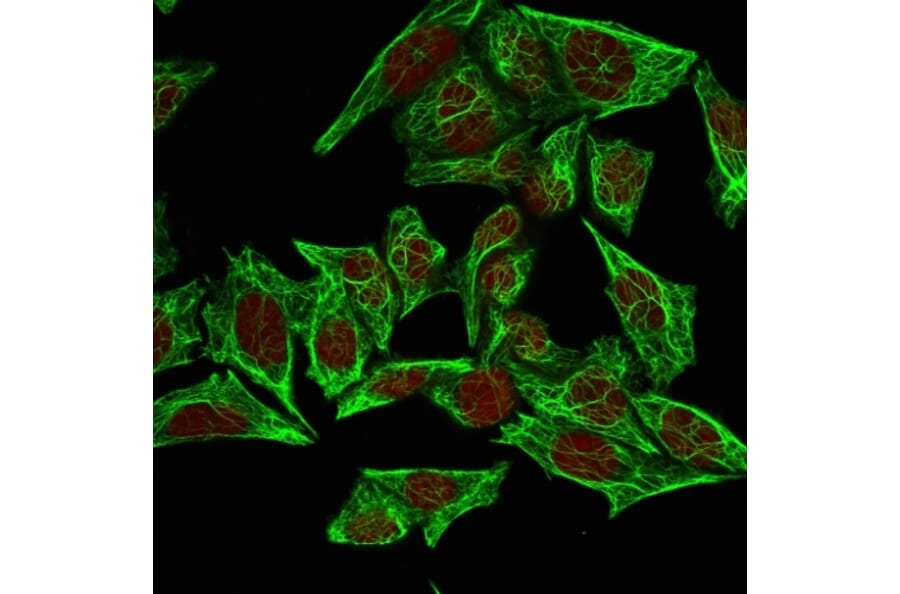 Immunofluorescence - Anti-Cytokeratin 7 Antibody [SPM270] (A249136) - Antibodies.com