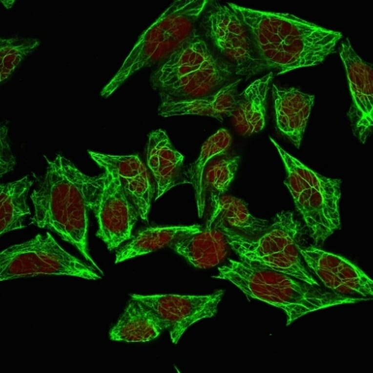 Immunofluorescence - Anti-Cytokeratin 7 Antibody [SPM270] (A249136) - Antibodies.com
