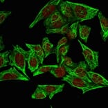 Immunofluorescence - Anti-Cytokeratin 7 Antibody [SPM270] (A249136) - Antibodies.com