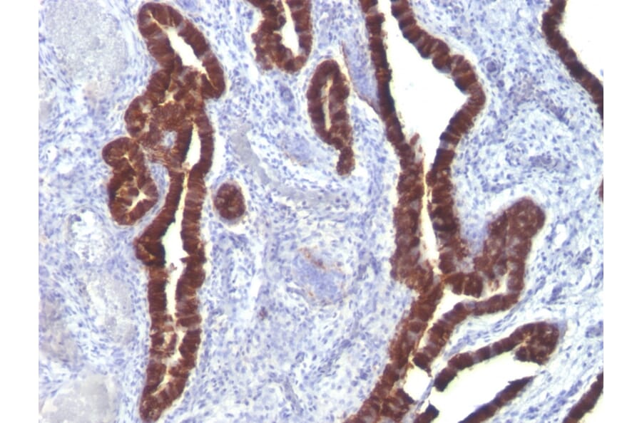 Immunohistochemistry - Anti-Cytokeratin 7 Antibody [K72.7] (A249137) - Antibodies.com