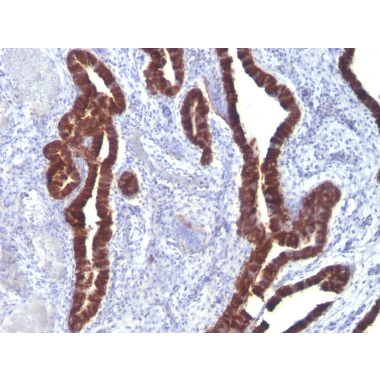 Immunohistochemistry - Anti-Cytokeratin 7 Antibody [K72.7] (A249137) - Antibodies.com
