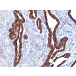 Immunohistochemistry - Anti-Cytokeratin 7 Antibody [K72.7] (A249137) - Antibodies.com