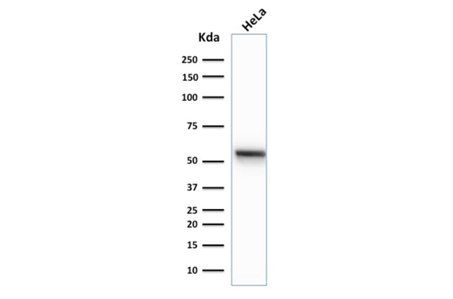 Western Blot - Anti-Cytokeratin 7 Antibody [K72.7] (A249137) - Antibodies.com