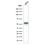 Western Blot - Anti-Cytokeratin 7 Antibody [K72.7] (A249137) - Antibodies.com