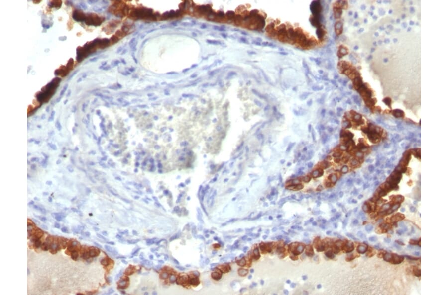 Immunohistochemistry - Anti-Cytokeratin 7 Antibody [KRT7/760] (A249139) - Antibodies.com