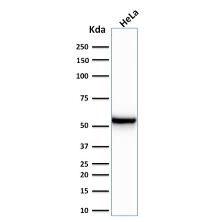 Western Blot - Anti-Cytokeratin 7 Antibody [KRT7/760] (A249139) - Antibodies.com