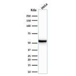 Western Blot - Anti-Cytokeratin 7 Antibody [KRT7/760] (A249139) - Antibodies.com