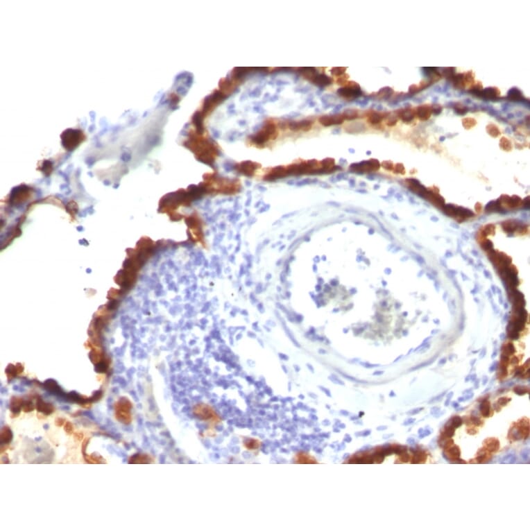 Immunohistochemistry - Anti-Cytokeratin 7 Antibody [KRT7/760 + KRT7/903] (A249140) - Antibodies.com