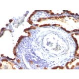 Immunohistochemistry - Anti-Cytokeratin 7 Antibody [KRT7/760 + KRT7/903] (A249140) - Antibodies.com