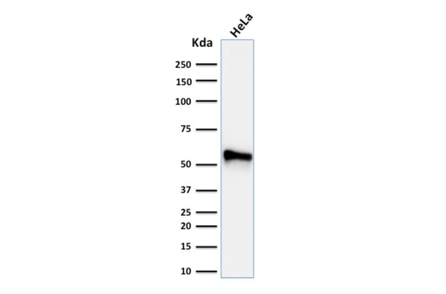 Western Blot - Anti-Cytokeratin 7 Antibody [KRT7/760 + KRT7/903] (A249140) - Antibodies.com