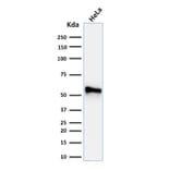 Western Blot - Anti-Cytokeratin 7 Antibody [KRT7/760 + KRT7/903] (A249140) - Antibodies.com