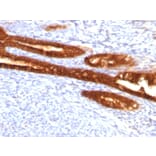 Immunohistochemistry - Anti-Cytokeratin 7 Antibody [KRT7/760 + KRT7/903] (A249140) - Antibodies.com