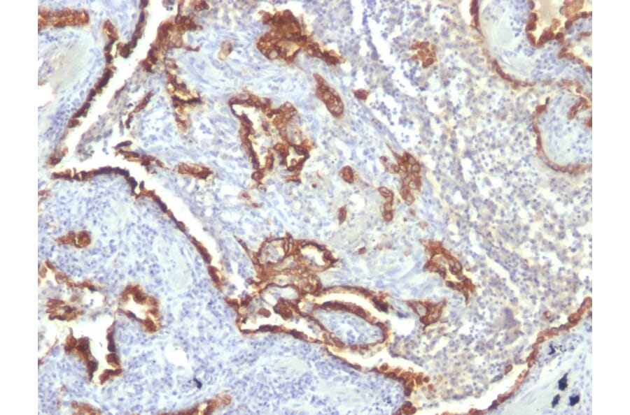 Immunohistochemistry - Anti-Cytokeratin 7 Antibody [KRT7/760 + OV-TL12/30] (A249141) - Antibodies.com