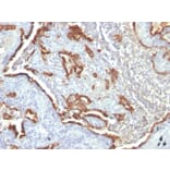 Immunohistochemistry - Anti-Cytokeratin 7 Antibody [KRT7/760 + OV-TL12/30] (A249141) - Antibodies.com