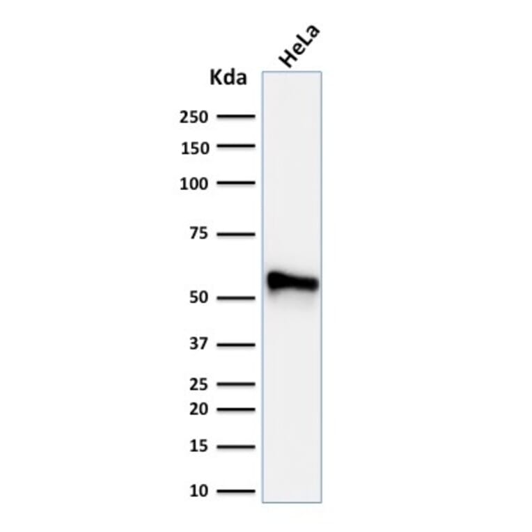 Western Blot - Anti-Cytokeratin 7 Antibody [KRT7/760 + OV-TL12/30] (A249141) - Antibodies.com