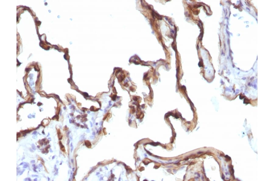 Immunohistochemistry - Anti-Cytokeratin 7 Antibody [KRT7/1198] (A249142) - Antibodies.com