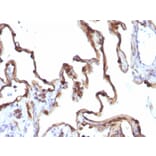 Immunohistochemistry - Anti-Cytokeratin 7 Antibody [KRT7/1198] (A249142) - Antibodies.com