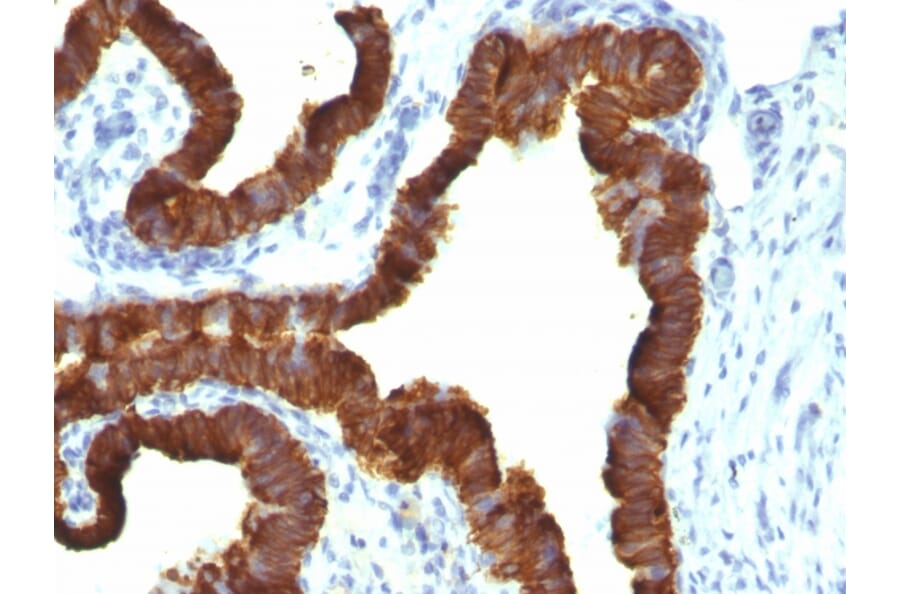 Immunohistochemistry - Anti-Cytokeratin 7 Antibody [KRT7/1198] (A249142) - Antibodies.com