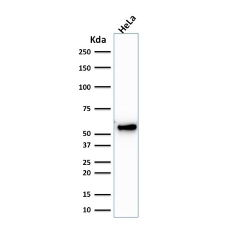 Western Blot - Anti-Cytokeratin 7 Antibody [KRT7/1198] (A249142) - Antibodies.com