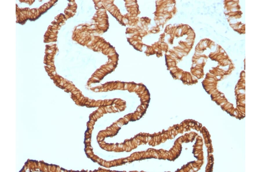 Immunohistochemistry - Anti-Cytokeratin 7 Antibody [KRT7/1499R] (A249143) - Antibodies.com