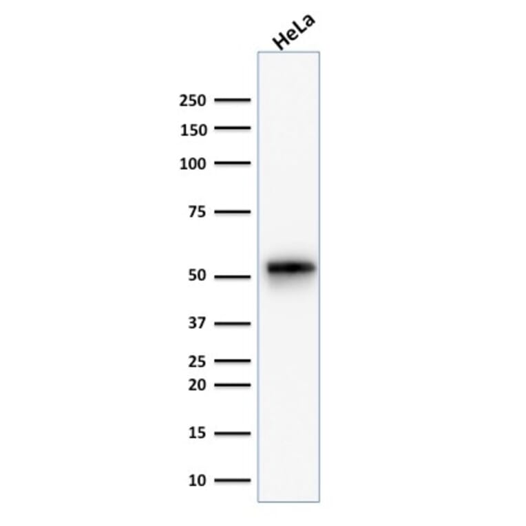 Western Blot - Anti-Cytokeratin 7 Antibody [KRT7/1499R] (A249143) - Antibodies.com