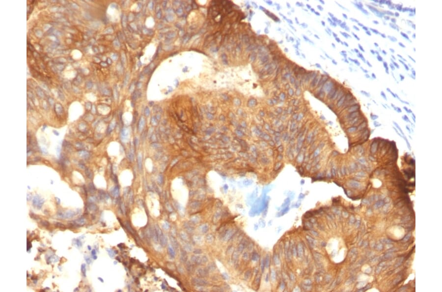 Immunohistochemistry - Anti-Cytokeratin 8 Antibody [B22.1] (A249144) - Antibodies.com