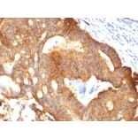 Immunohistochemistry - Anti-Cytokeratin 8 Antibody [B22.1] (A249144) - Antibodies.com