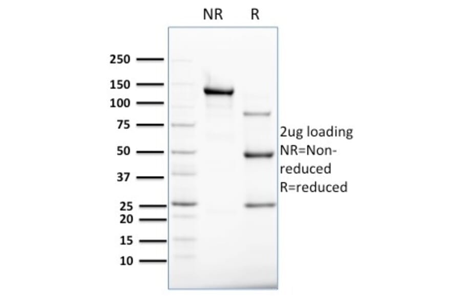 SDS-PAGE - Anti-Cytokeratin 8 Antibody [B22.1] (A249144) - Antibodies.com