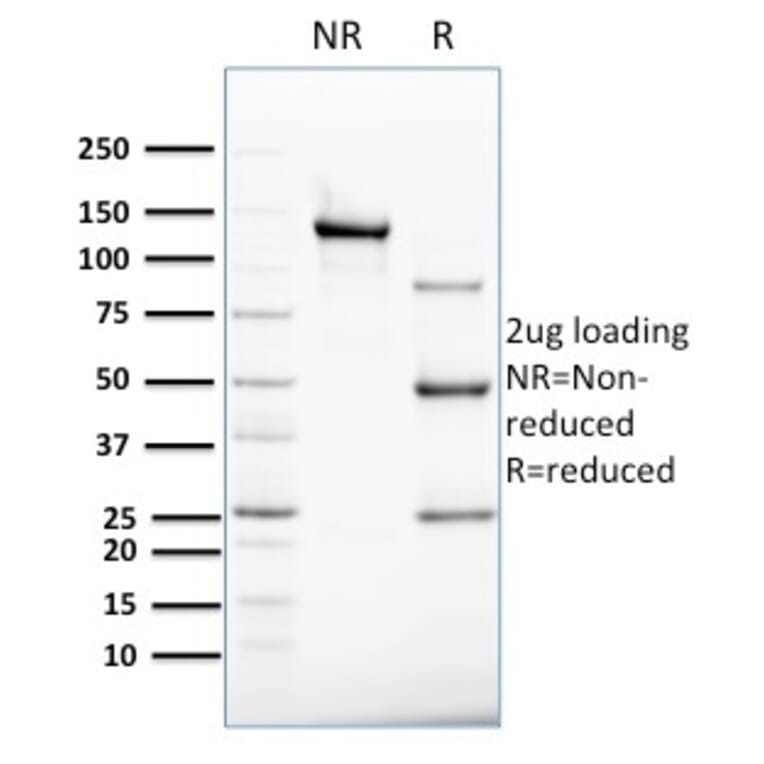 SDS-PAGE - Anti-Cytokeratin 8 Antibody [B22.1] (A249144) - Antibodies.com