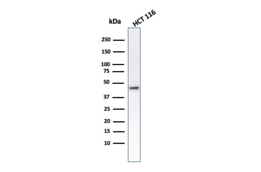 Western Blot - Anti-Cytokeratin 8 Antibody [B22.1] (A249144) - Antibodies.com