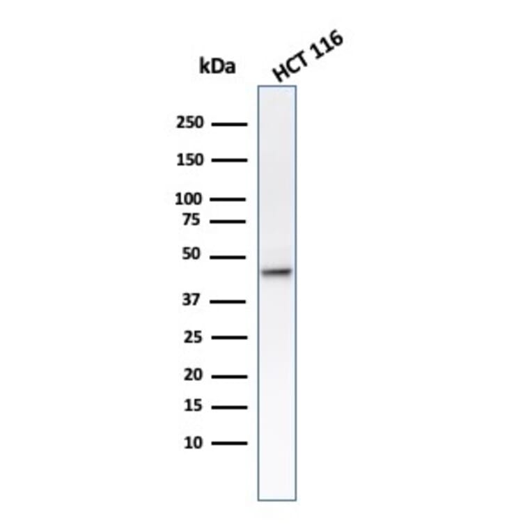 Western Blot - Anti-Cytokeratin 8 Antibody [B22.1] (A249144) - Antibodies.com