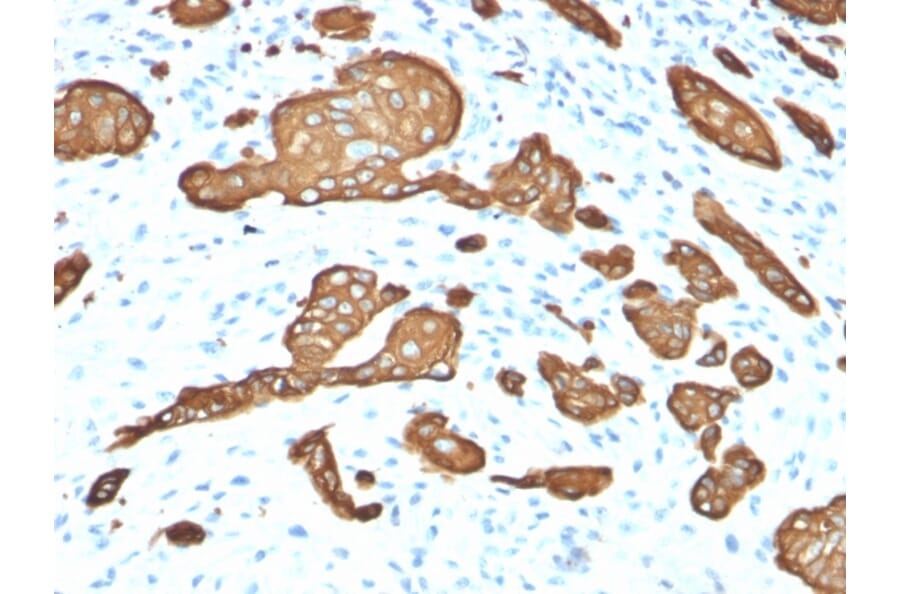 Immunohistochemistry - Anti-Cytokeratin 8 Antibody [KRT8/2115] (A249145) - Antibodies.com