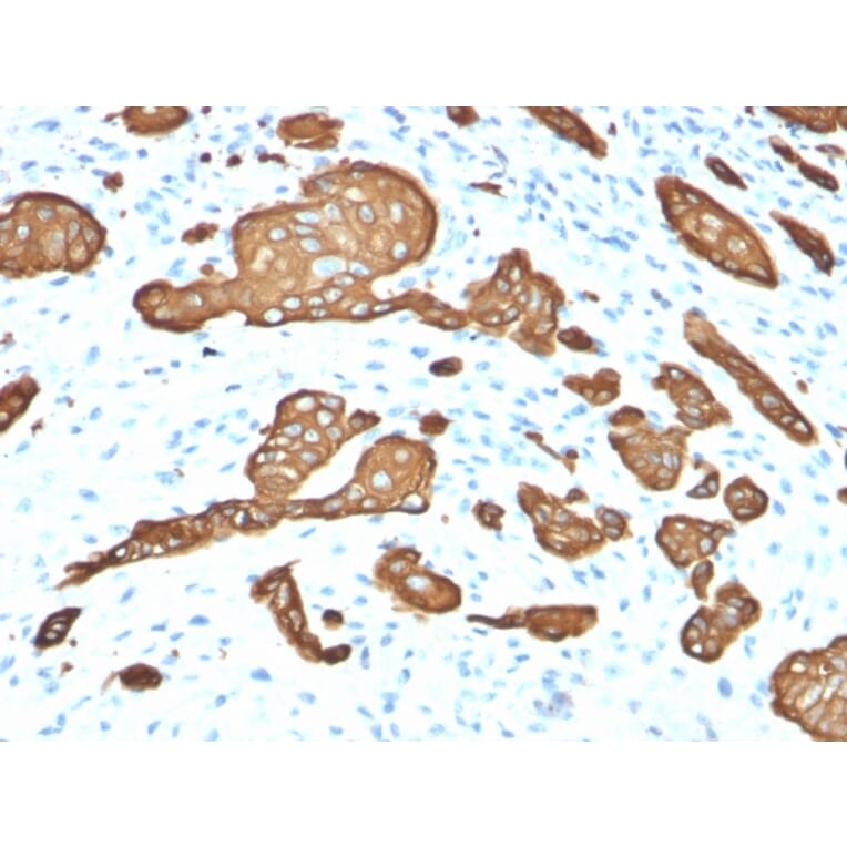Immunohistochemistry - Anti-Cytokeratin 8 Antibody [KRT8/2115] (A249145) - Antibodies.com