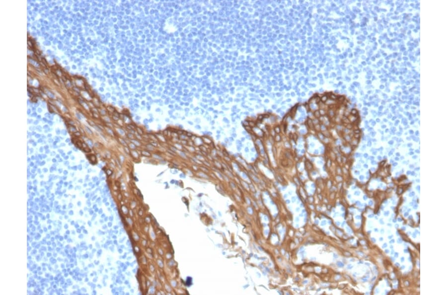 Immunohistochemistry - Anti-Cytokeratin 8 Antibody [KRT8/2115] (A249145) - Antibodies.com