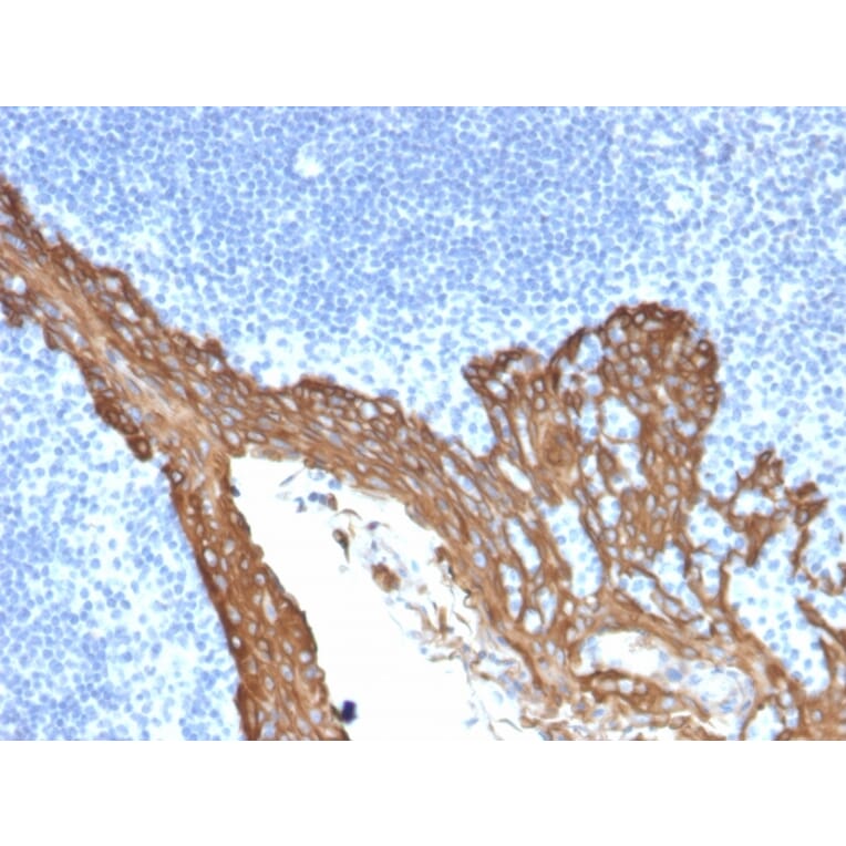 Immunohistochemistry - Anti-Cytokeratin 8 Antibody [KRT8/2115] (A249145) - Antibodies.com