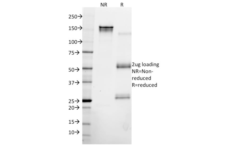 SDS-PAGE - Anti-Cytokeratin 8 Antibody [KRT8/2115] (A249145) - Antibodies.com