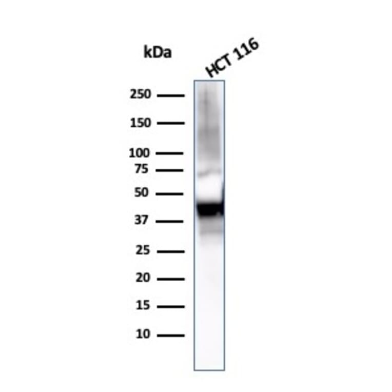 Western Blot - Anti-Cytokeratin 8 Antibody [KRT8/2115] (A249145) - Antibodies.com