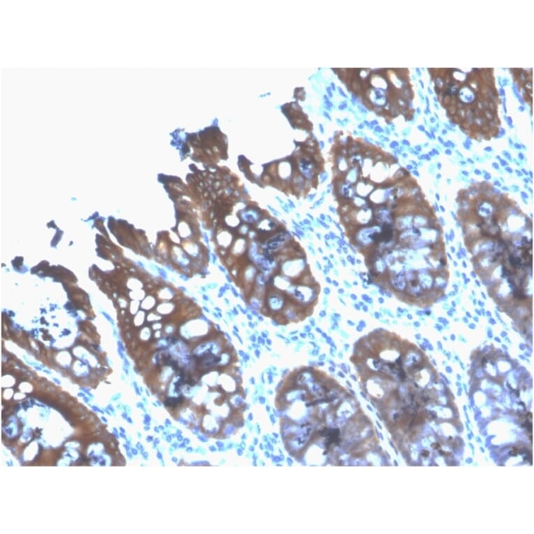 Immunohistochemistry - Anti-Cytokeratin 8 Antibody [rB22.1] (A249145) - Antibodies.com