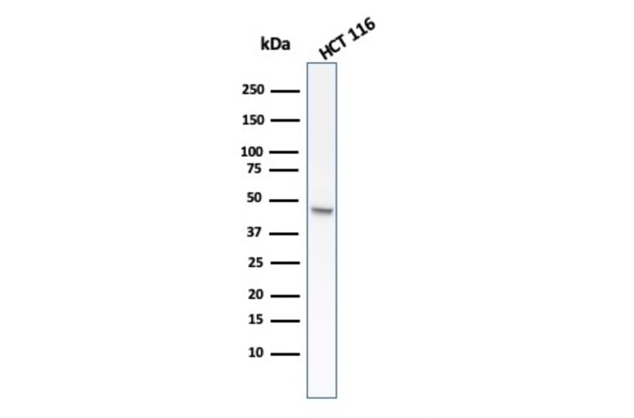 Western Blot - Anti-Cytokeratin 8 Antibody [rB22.1] (A249146) - Antibodies.com