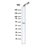 Western Blot - Anti-Cytokeratin 8 Antibody [rB22.1] (A249146) - Antibodies.com