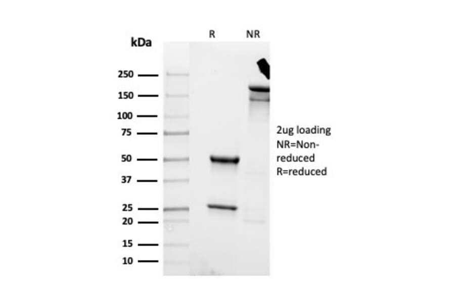 SDS-PAGE - Anti-Cytokeratin 8 Antibody [rKRT8/4209] (A249147) - Antibodies.com
