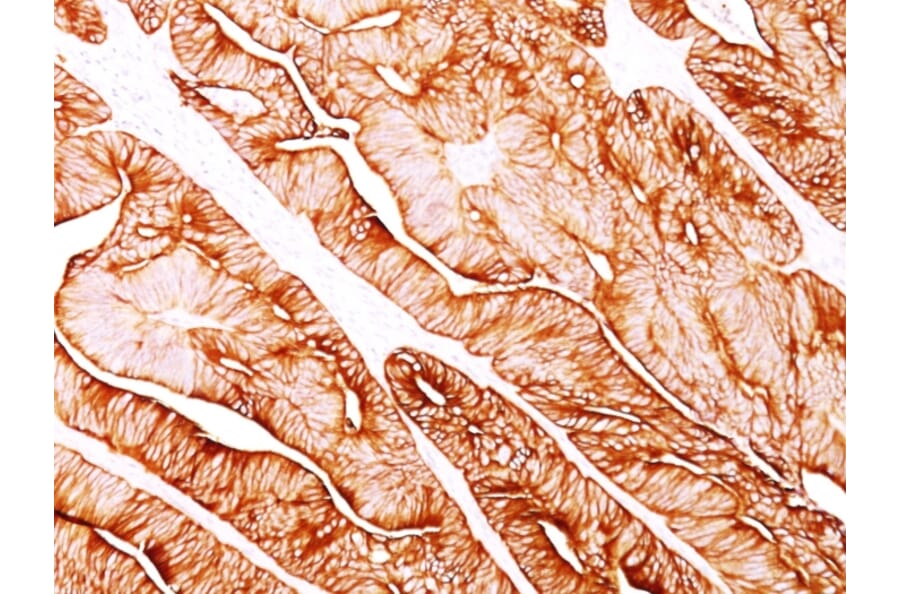 Immunohistochemistry - Anti-Cytokeratin 8 Antibody [H1] (A249148) - Antibodies.com