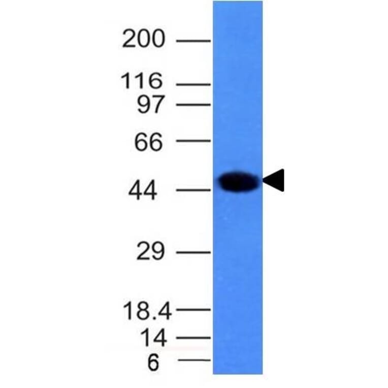 Western Blot - Anti-Cytokeratin 8 Antibody [H1] (A249148) - Antibodies.com