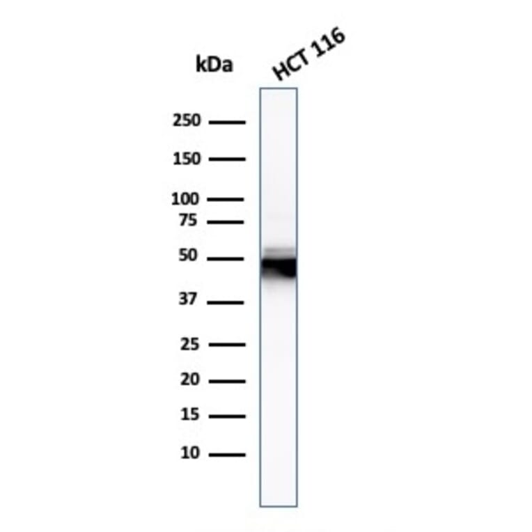 Western Blot - Anti-Cytokeratin 8 Antibody [H1] (A249148) - Antibodies.com