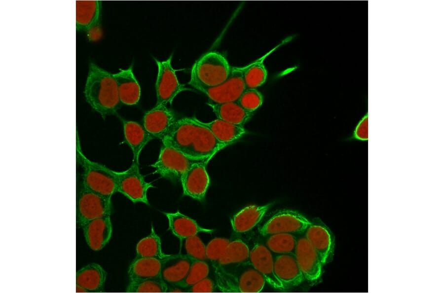 Immunofluorescence - Anti-Cytokeratin 8 Antibody [SPM538] (A249149) - Antibodies.com