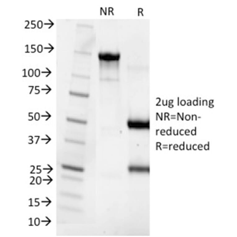 SDS-PAGE - Anti-Cytokeratin 8 Antibody [SPM538] (A249149) - Antibodies.com