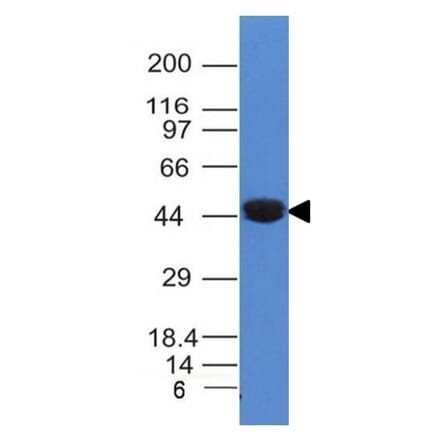 Western Blot - Anti-Cytokeratin 8 Antibody [K8/383] (A249150) - Antibodies.com