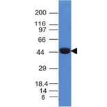 Western Blot - Anti-Cytokeratin 8 Antibody [K8/383] (A249150) - Antibodies.com