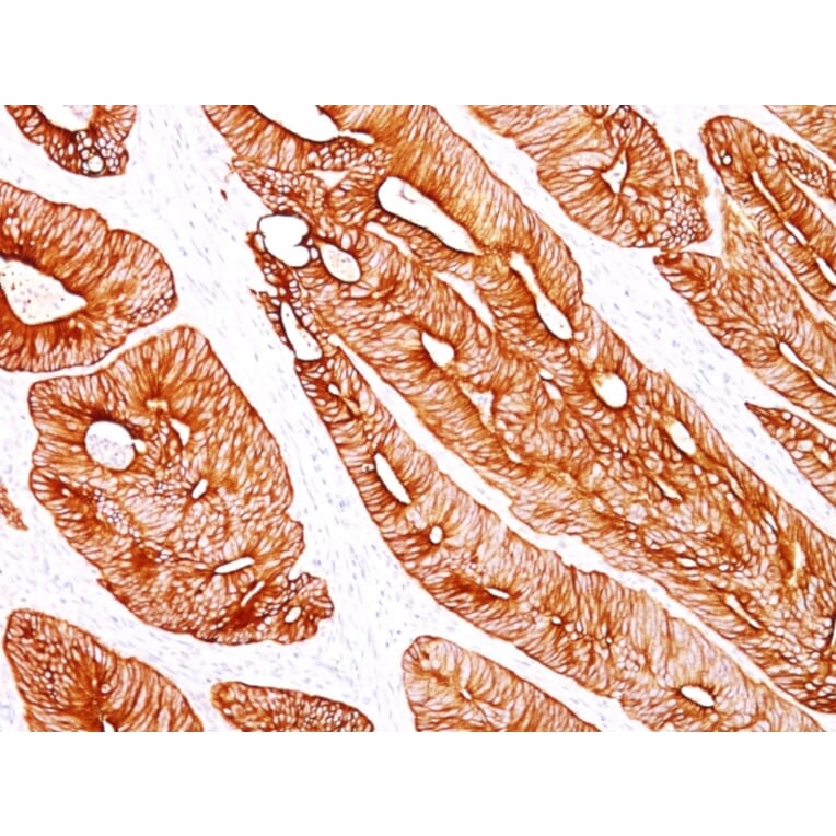 Immunohistochemistry - Anti-Cytokeratin 8 Antibody [K8/383] (A249150) - Antibodies.com