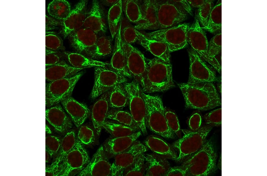 Immunofluorescence - Anti-Cytokeratin 8 Antibody [TS1] (A249151) - Antibodies.com